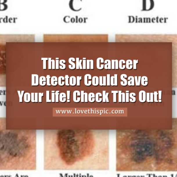 5 Million People Are Treated For Skin Cancer Each Year. This Skin Cancer Detector Could Save Your Life!