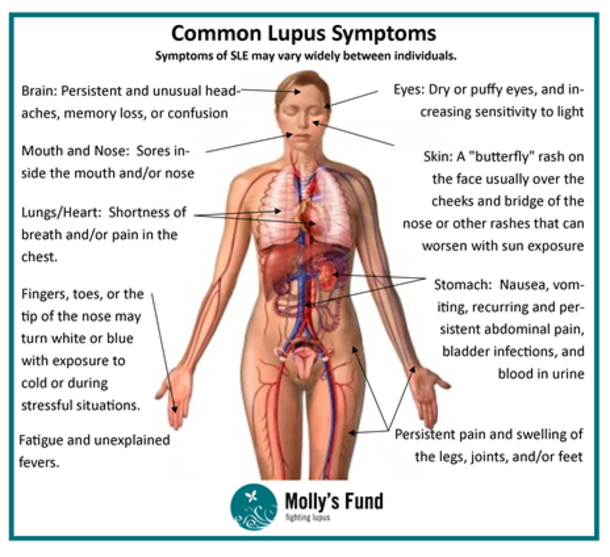 5 Strange And Unusual Facts About Lupus You Should Know - picture 3
