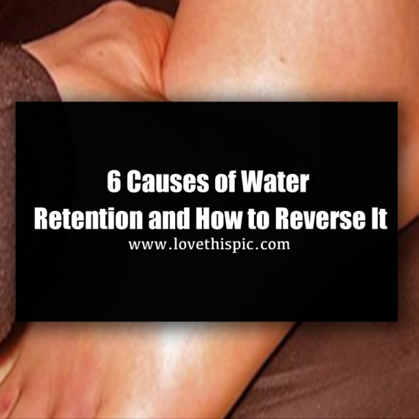 6 Causes of Water Retention and How to Reverse It