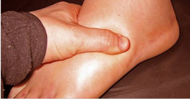 6 Causes of Water Retention and How to Reverse It - picture 2