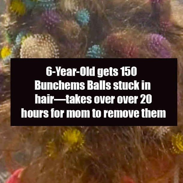 6-Year-Old gets 150 Bunchems Balls stuck in hair—takes over over 20 hours for mom to remove them