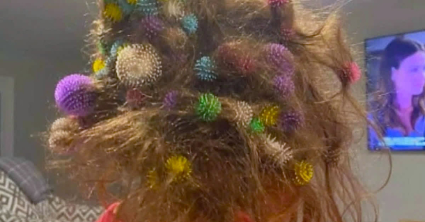 6-Year-Old gets 150 Bunchems Balls stuck in hair—takes over over 20 hours for mom to remove them - picture 2
