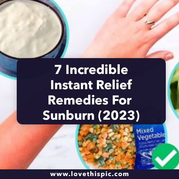 7 Incredible Instant Relief Remedies For Sunburn (2023)
