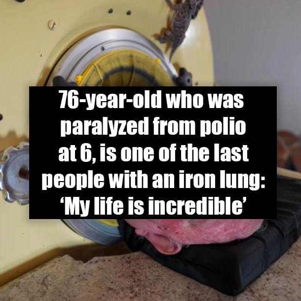 76-year-old who was paralyzed from polio at 6, is one of the last people with an iron lung: ‘My life is incredible’
