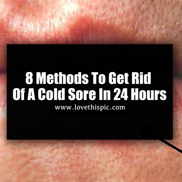 8 Methods To Get Rid Of A Cold Sore In 24 Hours