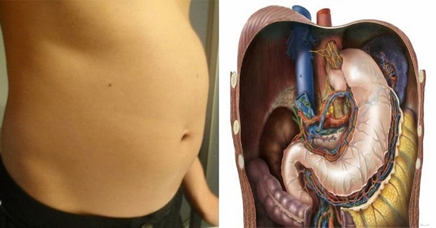 8 Reasons For A Bloated Stomach and How To Reduce It Using These Natural Remedies - picture 2