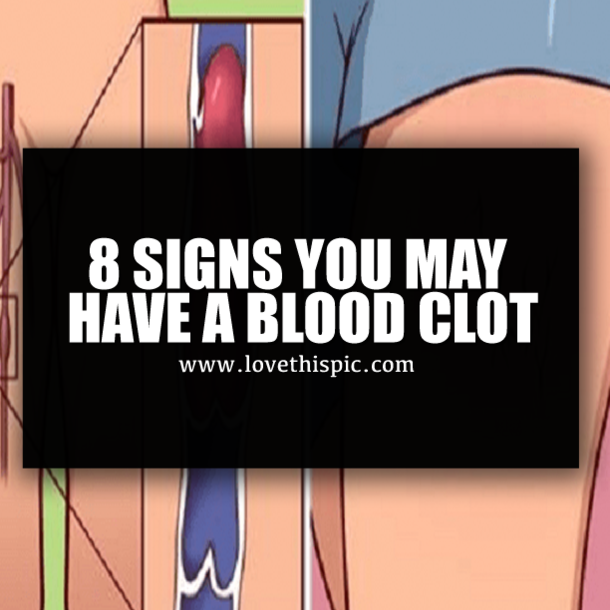 8 SIGNS YOU MAY HAVE A BLOOD CLOT