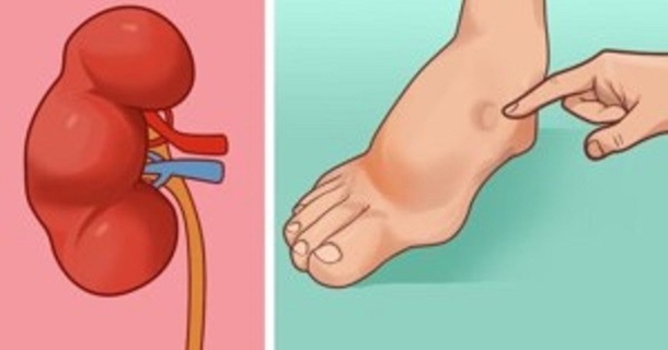 8 Ways Your Body Is Telling You You’re Going To Have A Stroke —The Hidden Symptoms Everyone Should Know - picture 7