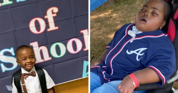 8-year-old boy cannot communicate and is left minimally conscious after choking on grape four years ago - picture 2