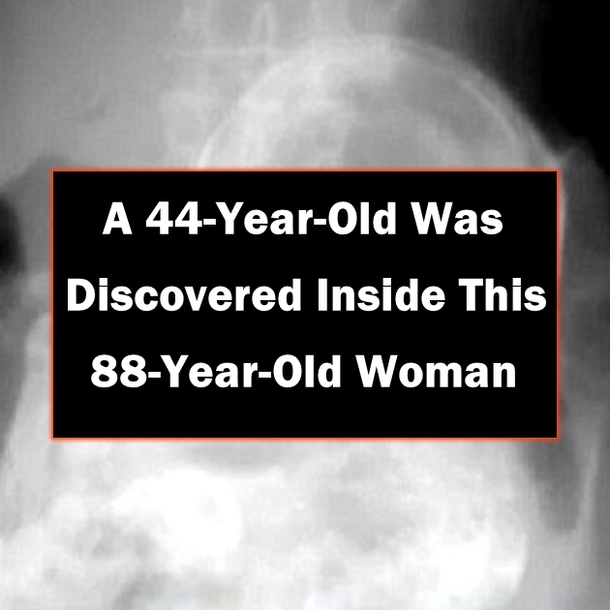 A 44-Year-Old Was Discovered Inside This 88-Year-Old Woman