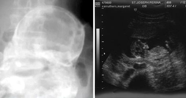 A 44-Year-Old Was Discovered Inside This 88-Year-Old Woman - picture 2
