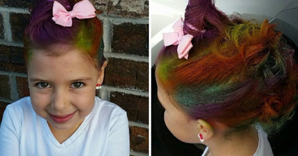 A Little Girl's Hair Falls Out Suddenly. Her Parents Are In Complete Shock & Confusion, When They See A Doctor? She Is Bald - picture 2