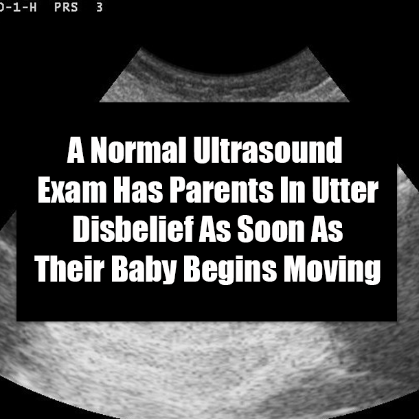 A Normal Ultrasound Exam Has Parents In Utter Disbelief As Soon As Their Baby Begins Moving