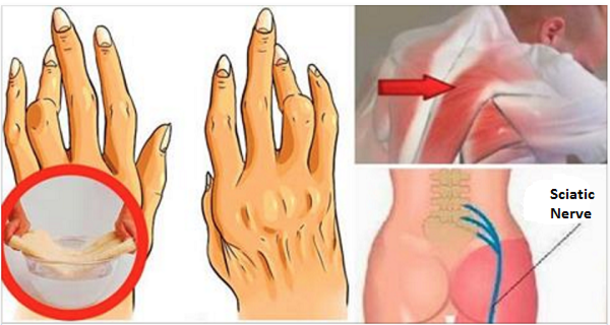 A Simple And Easy Trick For Removing Arthritis, Back Pain And Sciatica. Works Better Than Pills! - picture 2