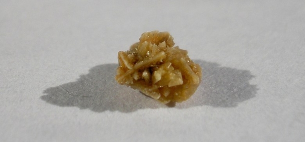 A Very Effective Home Remedy for Kidney Stones - picture 2