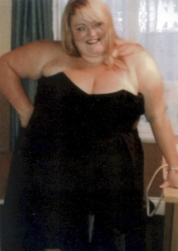 A Woman Lost 200 Pounds In A Year And A Half By Doing This Simple Thing, WOW This Is Unbelievable! - picture 3