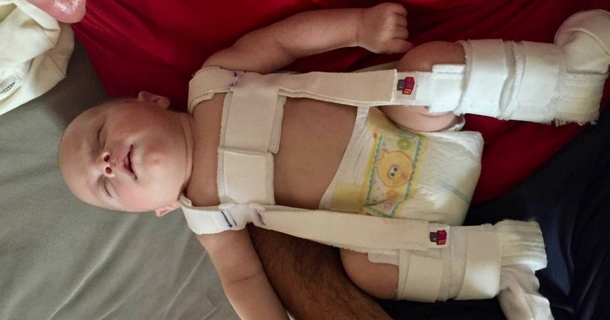 Adorable Baby Came Into This World Addicted To Meth, However His Foster Parents Vowed To Never Leave His Side - picture 4