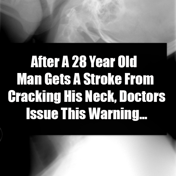 After A 28 Year Old Man Gets A Stroke From Cracking His Neck, Doctors Issue This Warning...