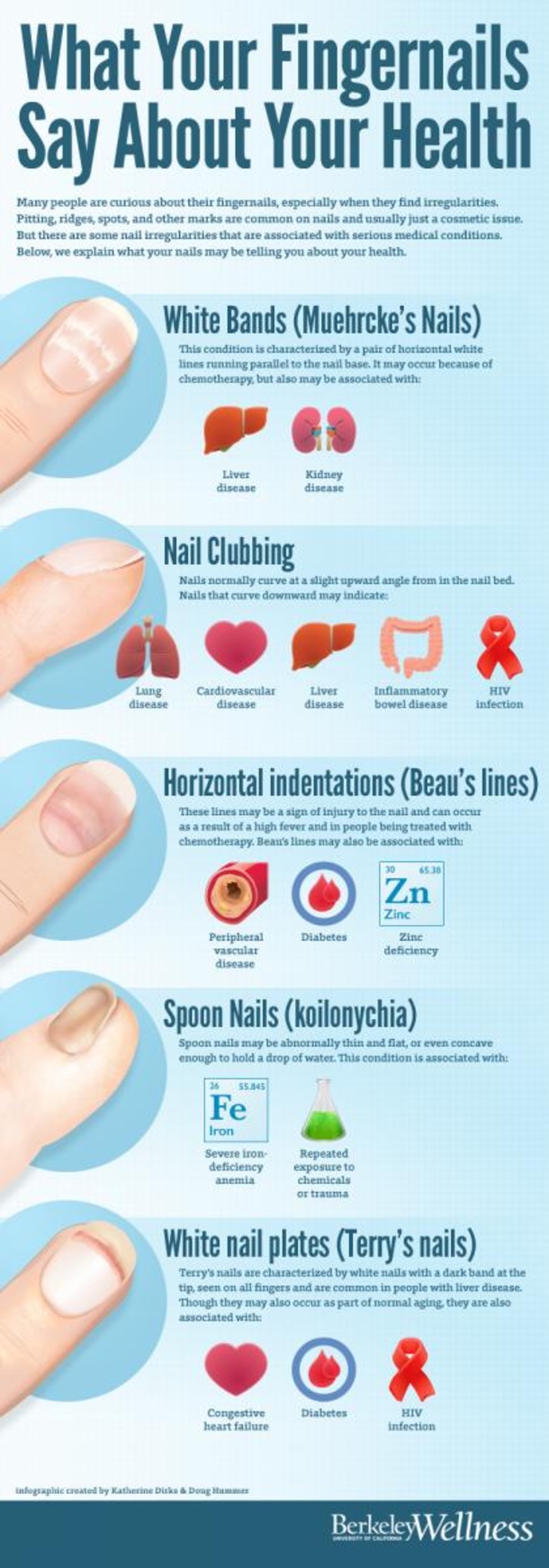 After Reading The Hazards And Adverse Effects Of Nail Biting You Will Never Bite Your Nails Again - picture 7