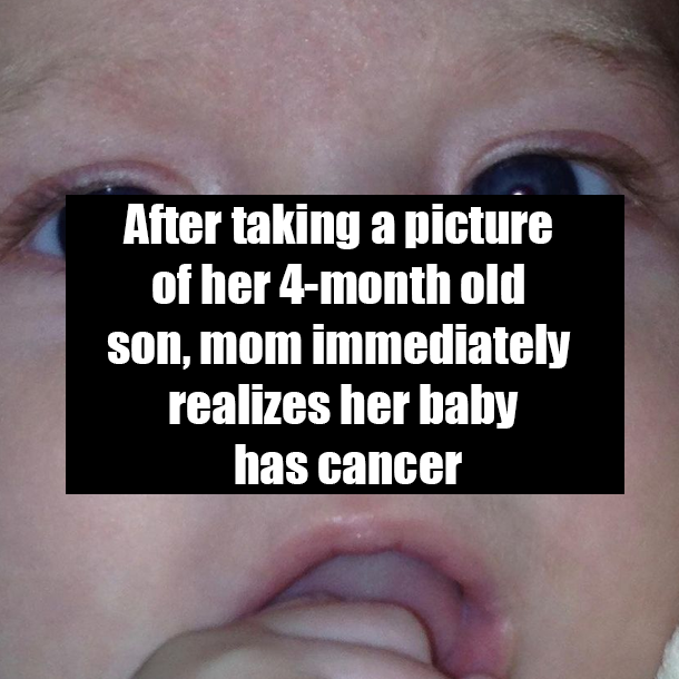 After taking a picture of her 4-month old son, mom immediately realizes her baby has cancer