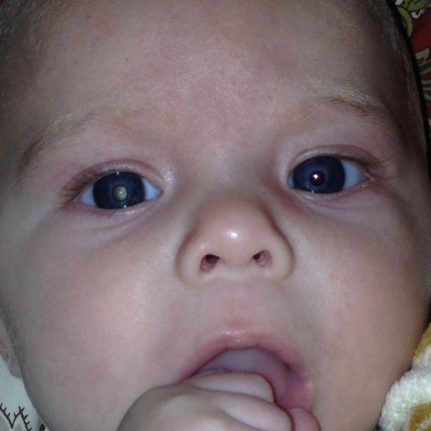 After taking a picture of her 4-month old son, mom immediately realizes her baby has cancer - picture 2