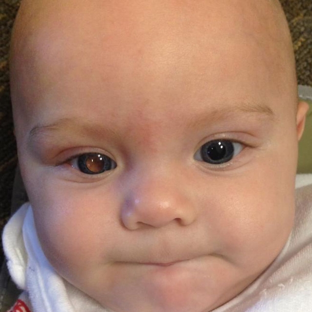 After taking a picture of her 4-month old son, mom immediately realizes her baby has cancer - picture 4