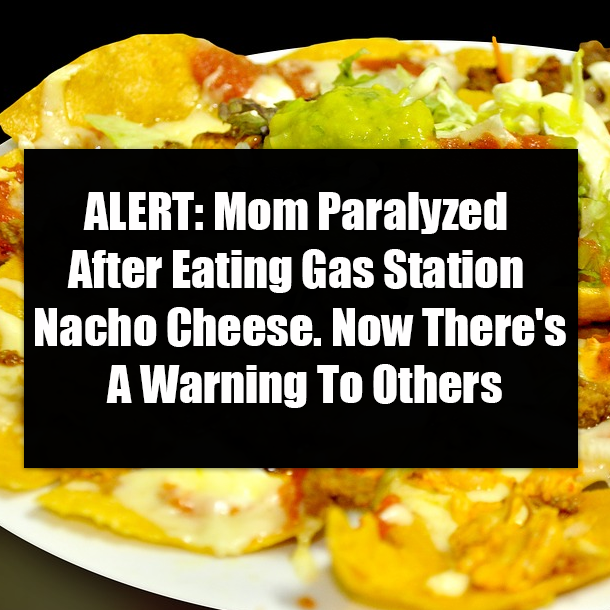 ALERT: Mom Paralyzed After Eating Gas Station Nacho Cheese. Now There's A Warning To Others