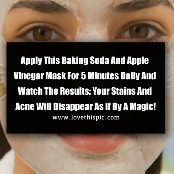 Apply This Baking Soda And Apple Vinegar Mask For 5 Minutes Daily And Watch The Results: Your Stains And Acne Will Disappear As If By A Magic!