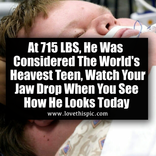 At 715 LBS, He Was Considered The World's Heavest Teen, Watch Your Jaw Drop When You See How He Looks Today