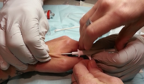 Australia Becomes First Country To Begin Microchipping Its Public - picture 2