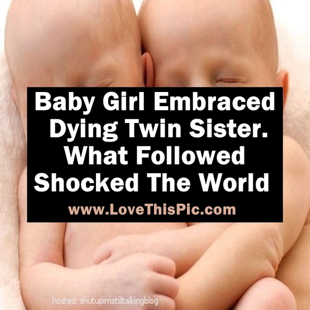 Baby Girl Embraced Dying Twin Sister. What Followed Shocked The World