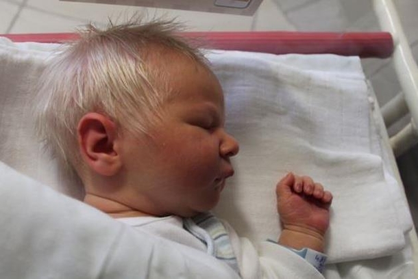 Baby Is Born With Head Full Of Gray Hair, Doctors Finally Realize Why - picture 2