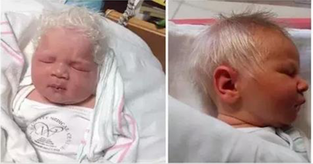 Baby Is Born With Head Full Of Gray Hair, Doctors Finally Realize Why - picture 3