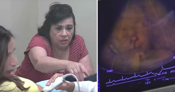 Baby Touches Face During Ultrasound, Then Grandma Demands Daughter Look At The Screen - picture 2