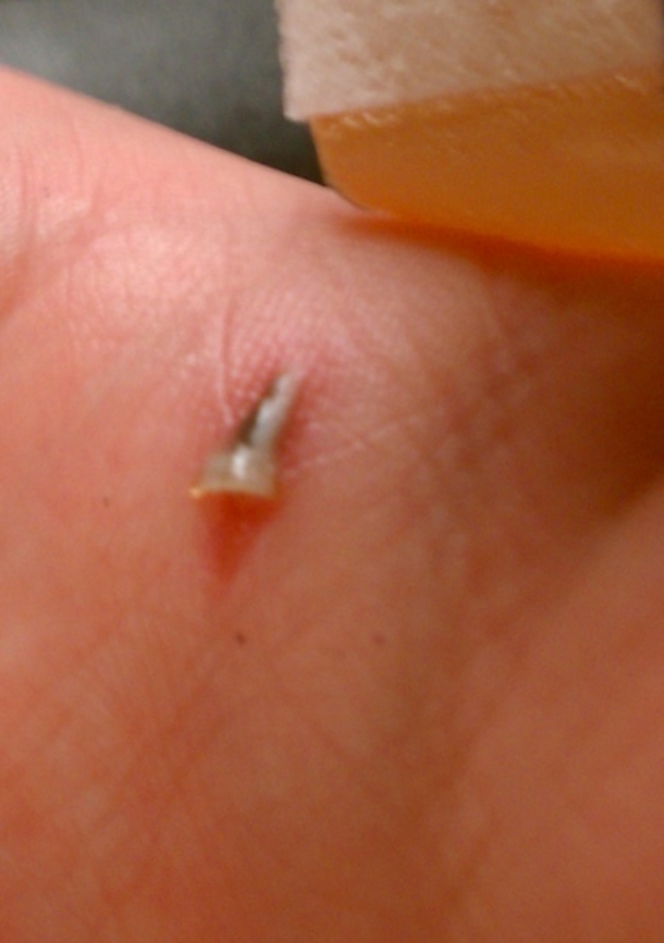 Baking Soda Has Many Purposes But Did You Know It Could Do This As Well? - picture 6