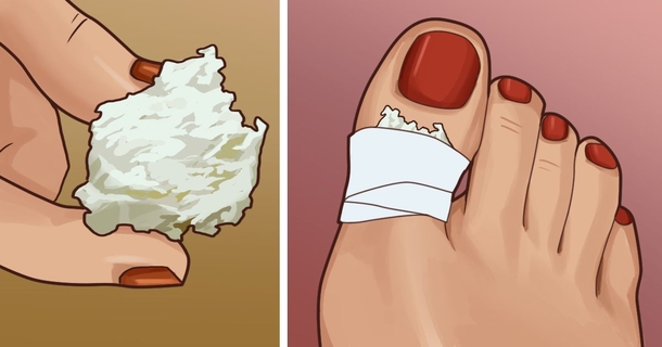 Bandage a piece of vinegar-soaked bread to your toe for this very helpful reason - picture 2