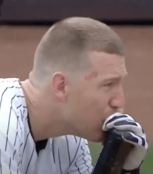 Baseball players accidentally hit 2-year-old little girl with 105 MPH foul ball, look sick with worry for her - picture 2