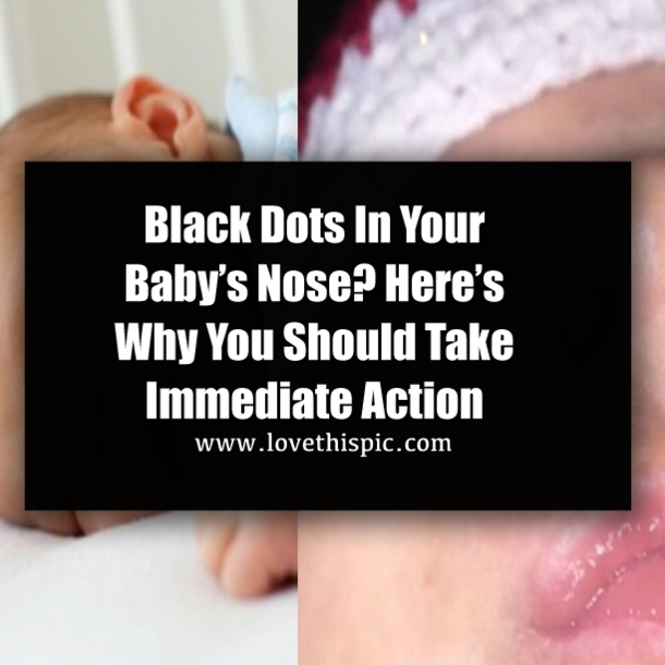 Black Dots In Your Baby’s Nose? Here’s Why You Should Take Immediate Action