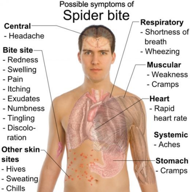 Black Widow Spiders Are Being Found In Supermarket Grapes. Here is What You Should Know... - picture 3