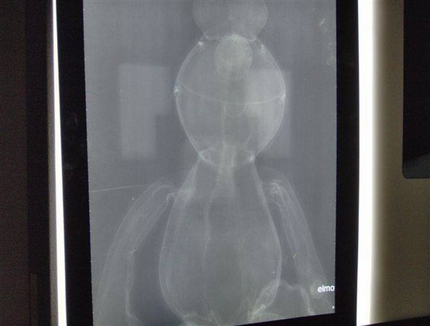 Boy Is Put Under For Surgery, Wakes Up To Discover Doctor Made Change Without Parents Knowing - picture 4