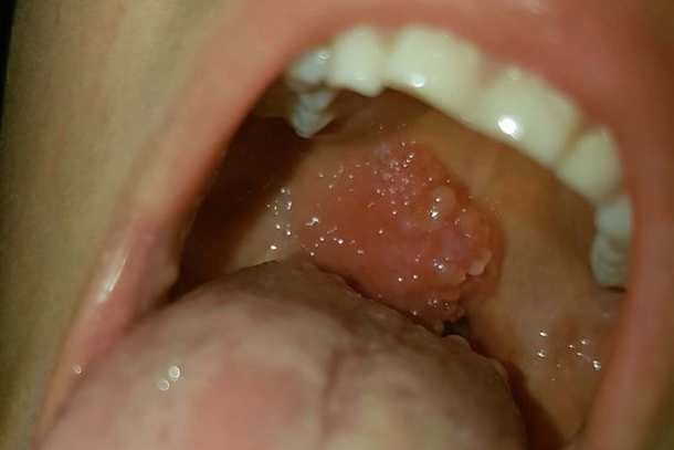 Boy Playing With Sister Spots VERY NASTY Surprise In Her Mouth, Mom Completely Freaks Out - picture 3