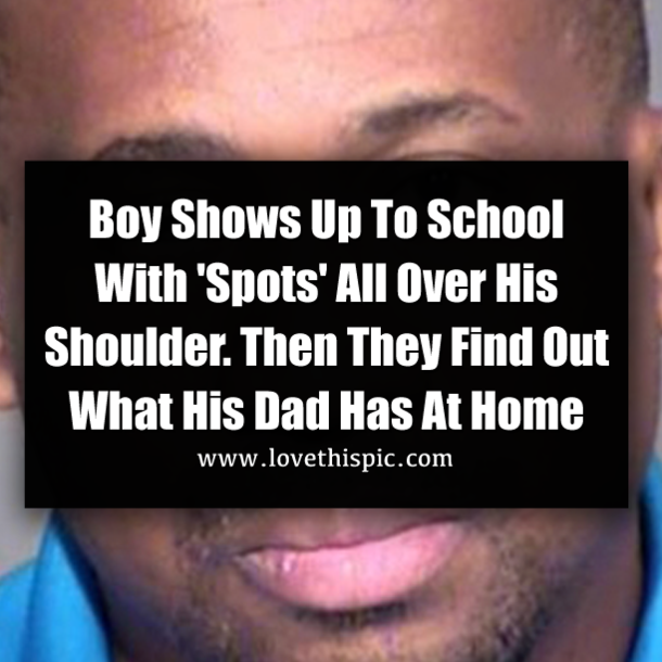 Boy Shows Up To School With 'Spots' All Over His Shoulder. Then They Find Out What His Dad Has At Home