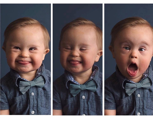 Boy With Down Syndrome Rejected by Osh Kosh B’gosh Because They Never “Requested a Special Needs Baby” - picture 2