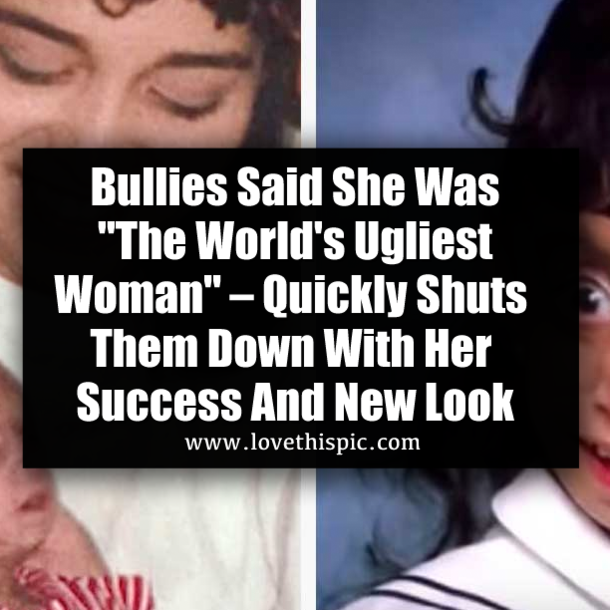 Bullies Said She Was "The World's Ugliest Woman" ​– Quickly Shuts Them Down With Her Success And New Look