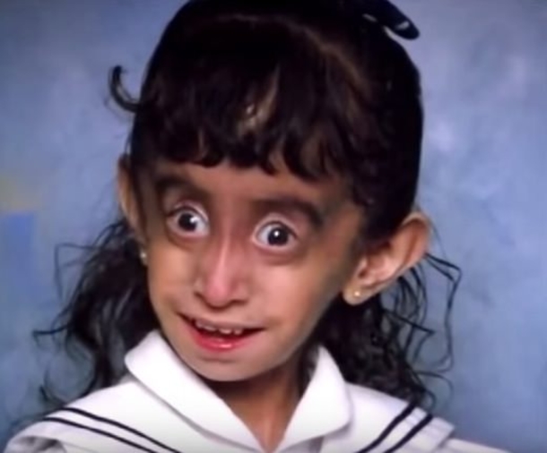 Bullies Said She Was "The World's Ugliest Woman" ​– Quickly Shuts Them Down With Her Success And New Look - picture 2