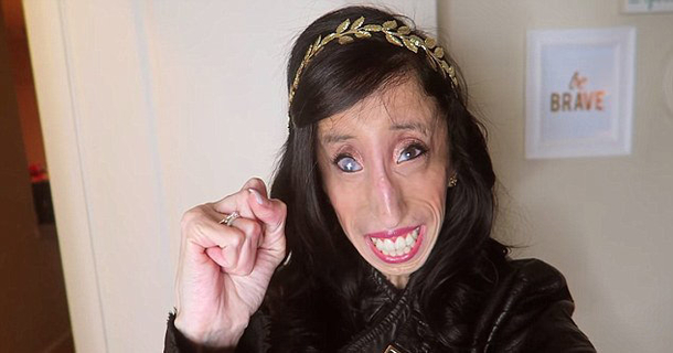 Bullies Said She Was "The World's Ugliest Woman" ​– Quickly Shuts Them Down With Her Success And New Look - picture 3