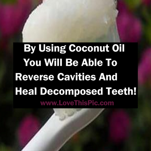 By Using Coconut Oil You Will Be Able To Reverse Cavities And Heal Decomposed Teeth!