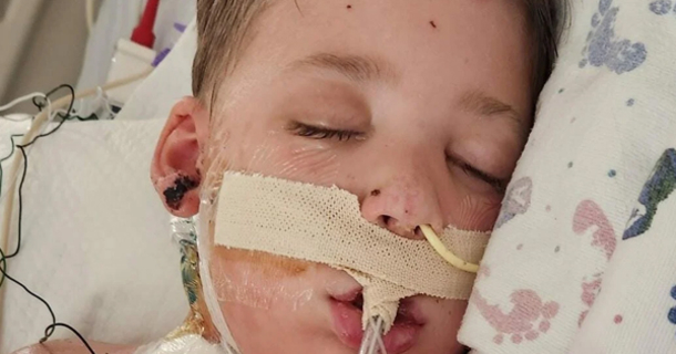 Car Hits 4-Year-Old Boy In Horrible Accident — But This “Tuff” Boy Clings On To Life! - picture 2