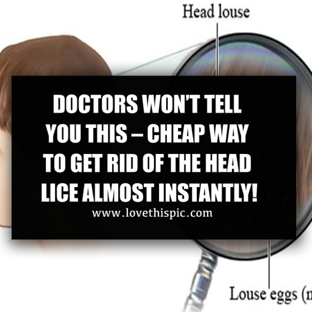CHEAP WAY TO GET RID OF HEAD LICE THAT DOCTORS WON’T TELL YOU