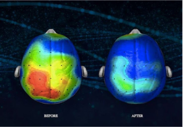 Check Out The Song That Neuroscientists Have Found Reduces Anxiety By 65 Percent - picture 2